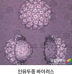 인유두종 바이러스 사진