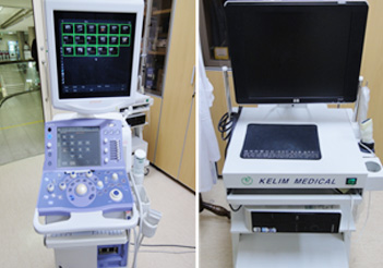 transcranial doppler